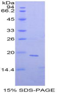 Figure 1. SDS-PAGE