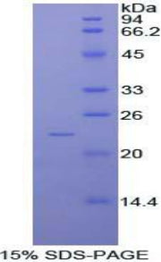 Figure 1. SDS-PAGE