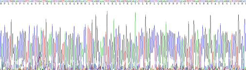 Recombinant Human N-Terminal Pro-Brain Natriuretic Peptide (NT-ProBNP)