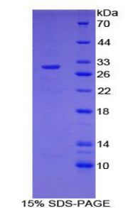 Figure 1. SDS-PAGE