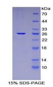 Figure 1. SDS-PAGE