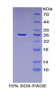 Figure 1. SDS-PAGE