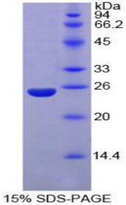 Figure 1. SDS-PAGE