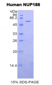 Figure 1. SDS-PAGE