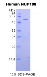 Figure 1. SDS-PAGE