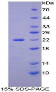 Figure 1. SDS-PAGE