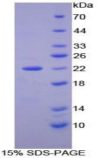 Figure 1. SDS-PAGE