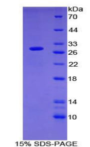 Figure 1. SDS-PAGE