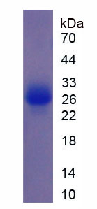Figure 1. SDS-PAGE