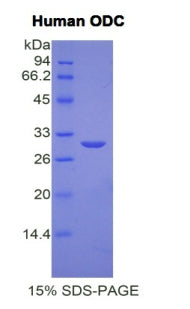 Figure 1. SDS-PAGE