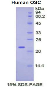 Figure 1. SDS-PAGE
