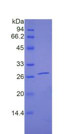 Figure 2. SDS-PAGE