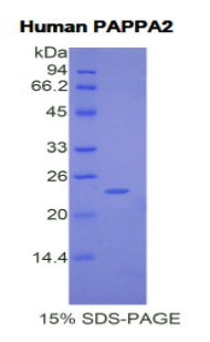Figure 1. SDS-PAGE
