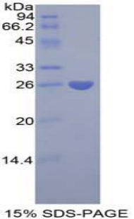Figure 1. SDS-PAGE