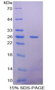 Figure 1. SDS-PAGE