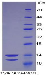 Figure 1. SDS-PAGE