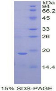 Figure 1. SDS-PAGE