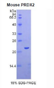 Figure 1. SDS-PAGE