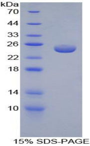 Figure 1. SDS-PAGE