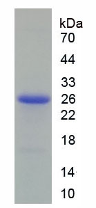 Figure 1. SDS-PAGE