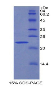 Figure 1. SDS-PAGE