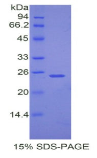 Figure 1. SDS-PAGE