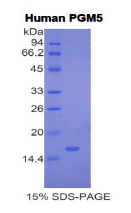 Figure 1. SDS-PAGE