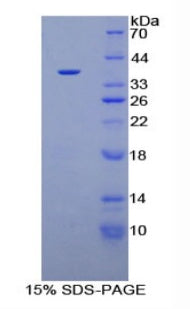 Figure 1. SDS-PAGE