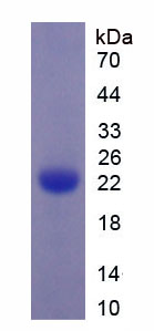 Figure 2. SDS-PAGE