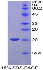 Figure 1. SDS-PAGE