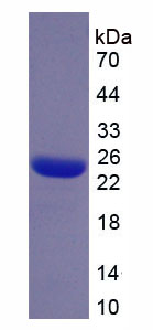Figure 1. SDS-PAGE
