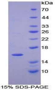 Figure 1. SDS-PAGE