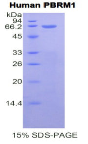 Figure 1. SDS-PAGE