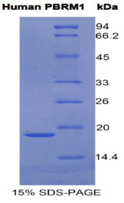 Figure 1. SDS-PAGE