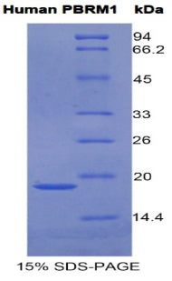 Figure 1. SDS-PAGE