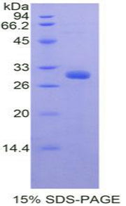 Figure 1. SDS-PAGE
