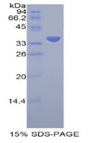 Figure 1. SDS-PAGE