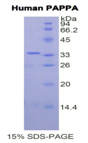 Figure 1. SDS-PAGE