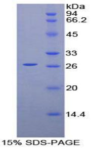 Figure 1. SDS-PAGE