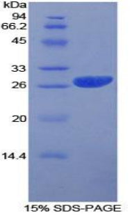Figure 1. SDS-PAGE