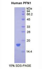 Figure 1. SDS-PAGE