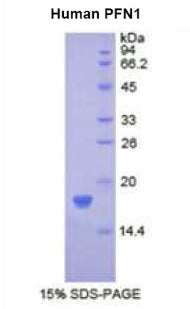 Figure 1. SDS-PAGE