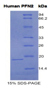 Figure 1. SDS-PAGE