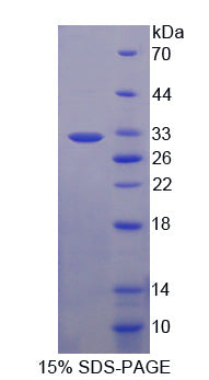 Figure 1. SDS-PAGE