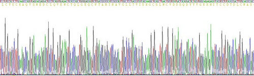 Recombinant Human Prostate Stem Cell Antigen (PSCA)