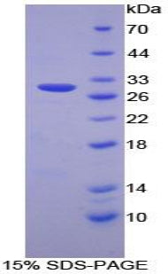 Figure 1. SDS-PAGE