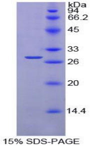 Figure 1. SDS-PAGE