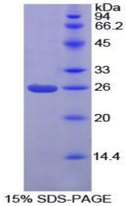 Figure 1. SDS-PAGE