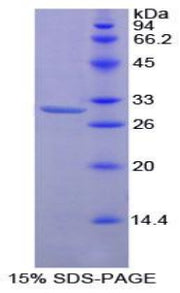 Figure 1. SDS-PAGE