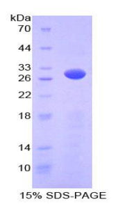 Figure 1. SDS-PAGE